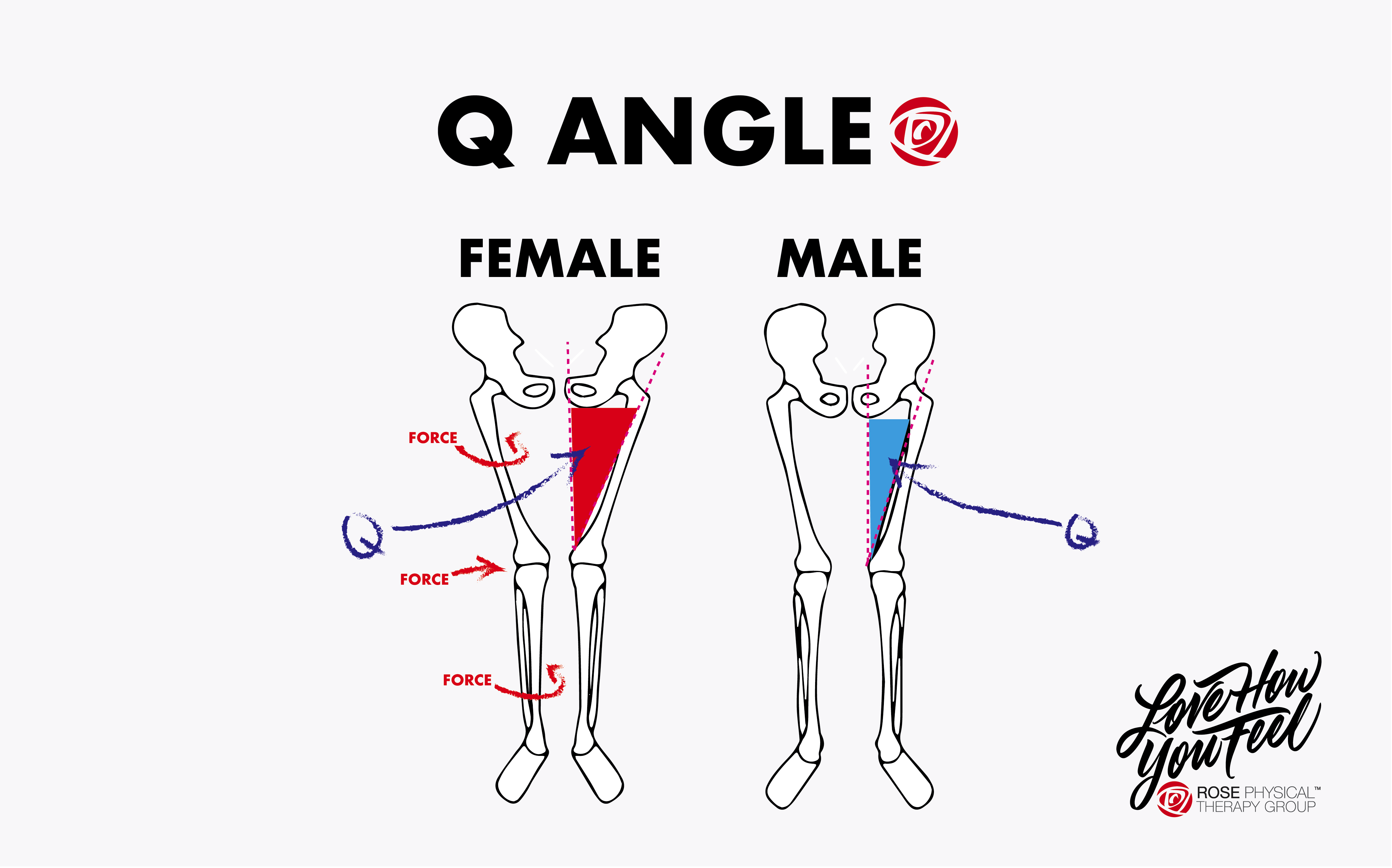 Q Angle men versus women